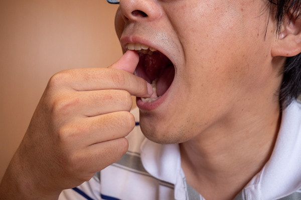 千葉県茂原市の歯医者、たけ歯科クリニックの顎関節症