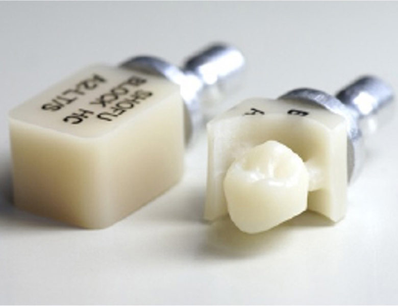 千葉県茂原市の歯医者、たけ歯科クリニックの審美歯科治療