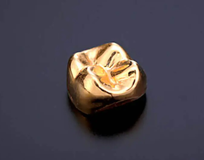 千葉県茂原市の歯医者、たけ歯科クリニックの審美歯科治療