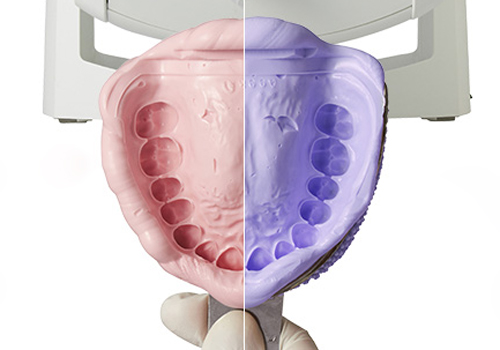 千葉県茂原市の歯医者、たけ歯科クリニックの審美歯科治療
